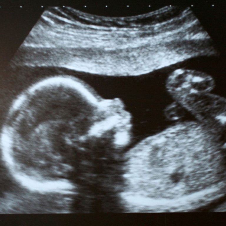 Ultrasound Boutique, United States
